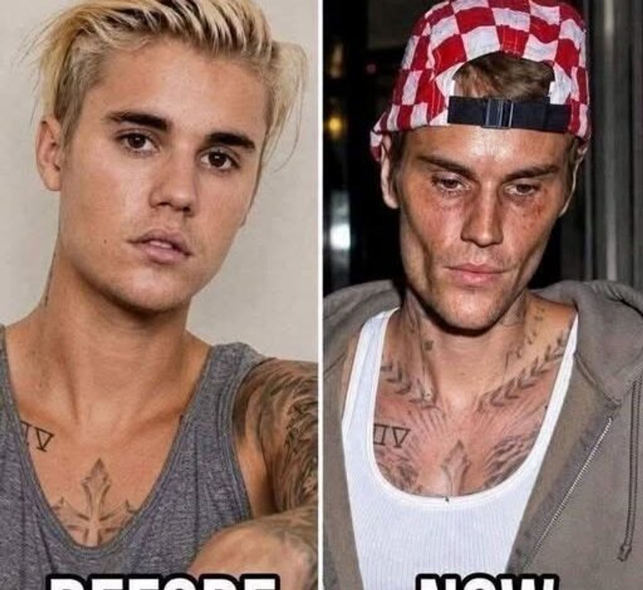 Justin Bieber Tested Positive What the Viral Headline Really Means